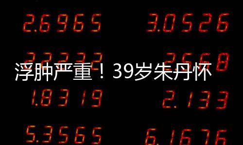 7个朱丹直播带货怀孕9岁深夜严重月 浮肿坚持
